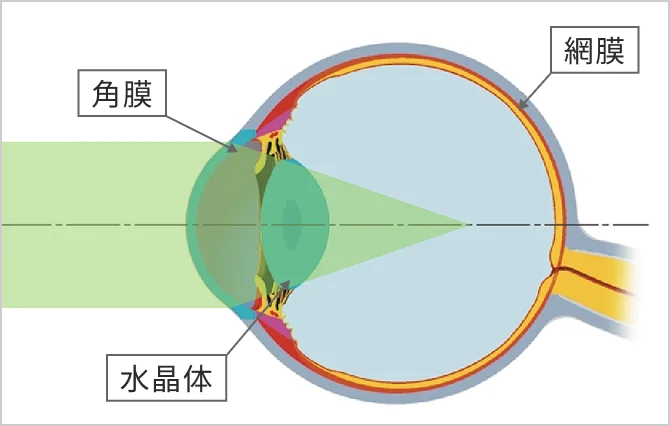 近視とは