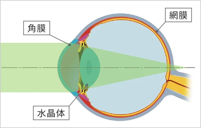 遠視とは