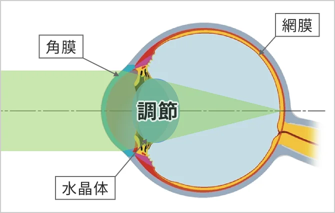 遠視とは