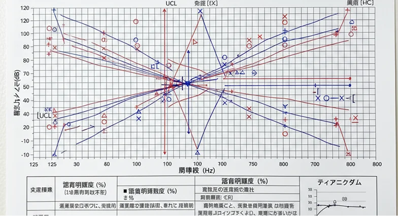 最大60項目にも及ぶ検査の測定結果を踏まえた補聴器のご提案