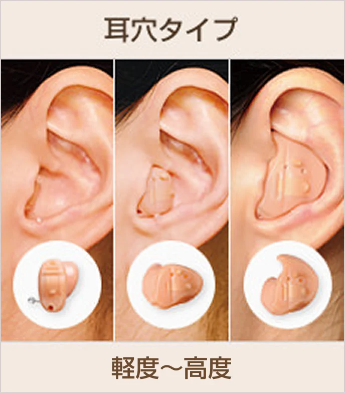 耳穴タイプ（軽度～高度）