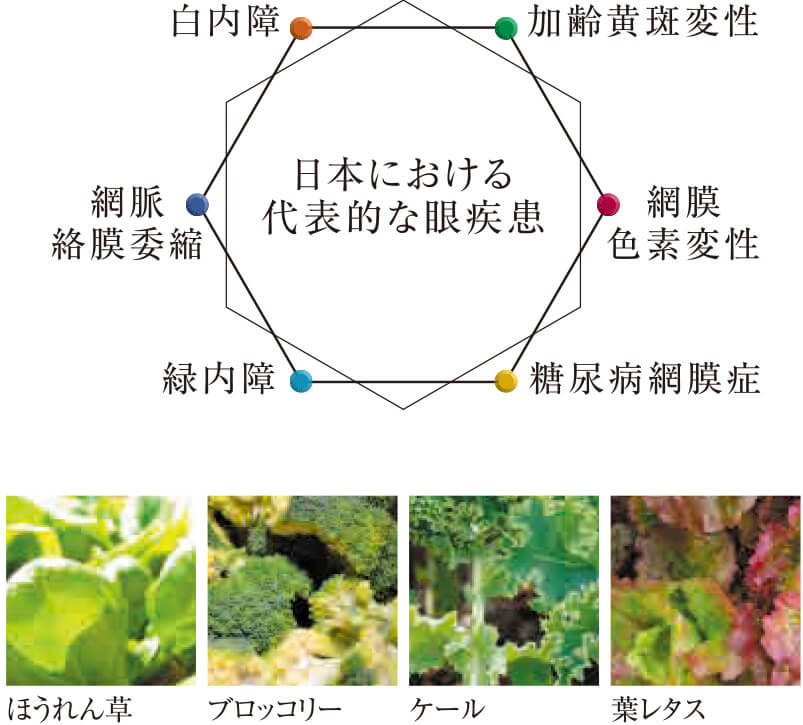 日本における代表的な眼疾患(白内障・加齢黄斑変性・網膜色素変性・糖尿病網膜症・緑内障・網脈絡膜委縮)と、ほうれん草・ブロッコリー・ケール・葉レタス