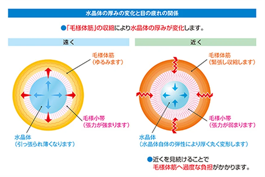２．毛様体筋の衰え