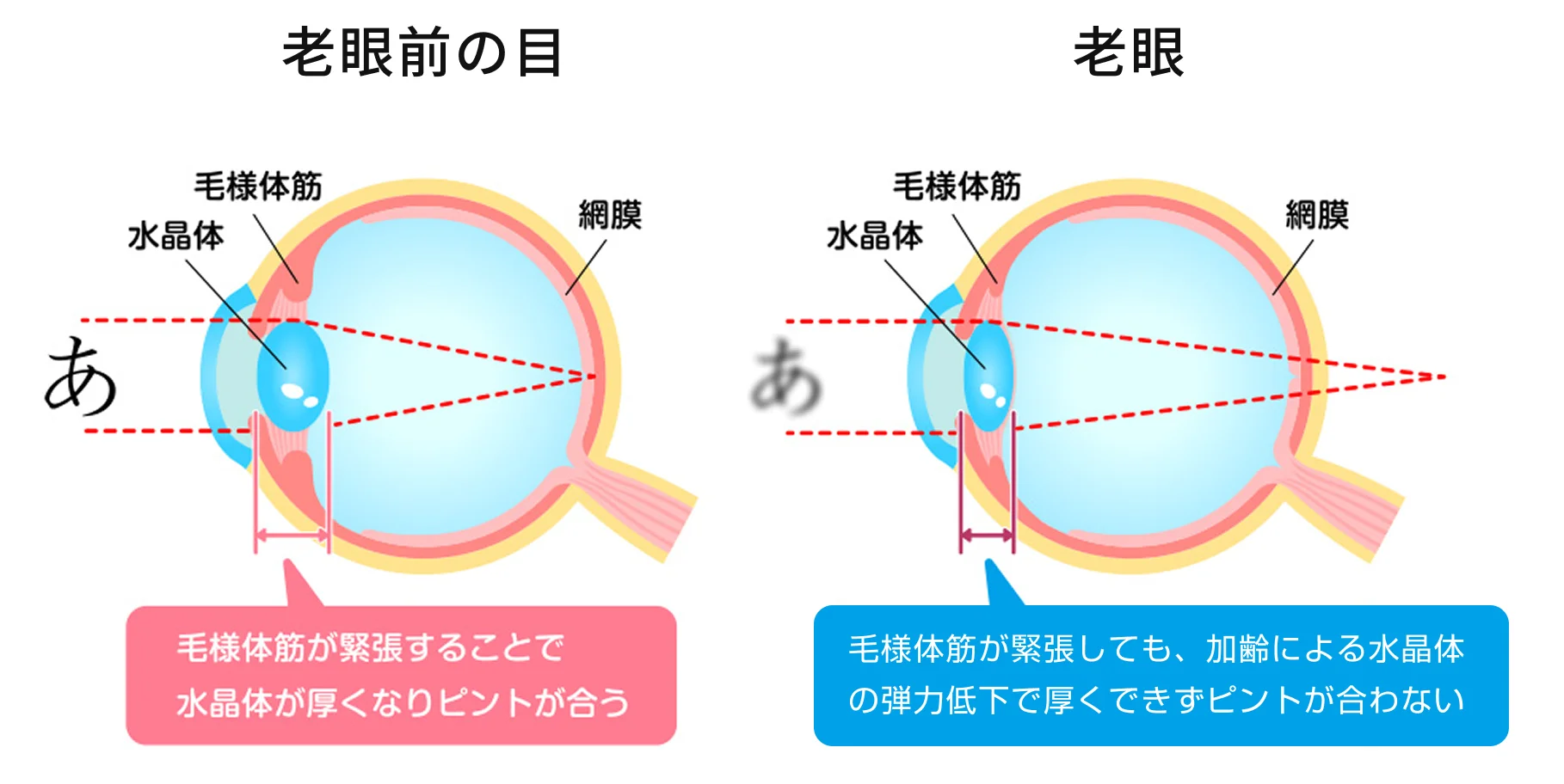 老眼の症状を示す図