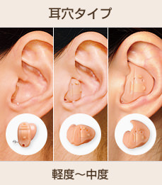 補聴器耳穴タイプ