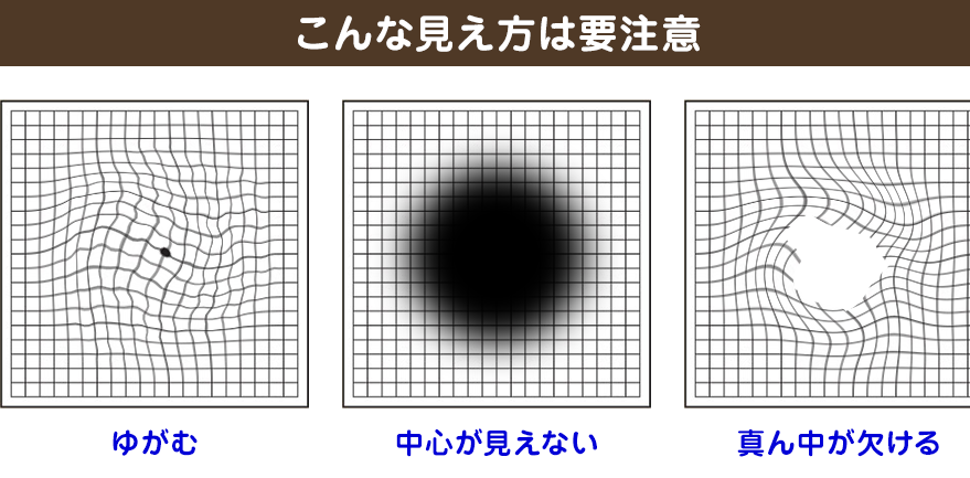 ゆがむ・中心が見えない・真ん中が欠けるような見え方をしたら要注意