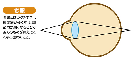 「老眼」と「スマホ老眼」の違いとは