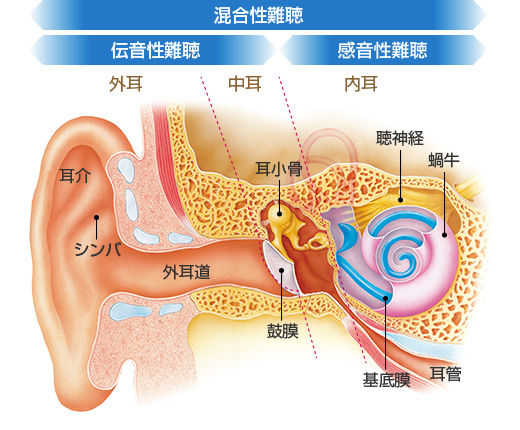 購入前に知っておきたいこと メガネスーパー 眼鏡 めがね メガネ コンタクト サングラス 補聴器販売