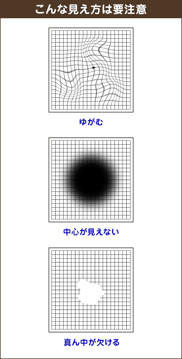 簡単チェック アムスラーチャート メガネスーパー 眼鏡 めがね メガネ コンタクト サングラス 補聴器販売