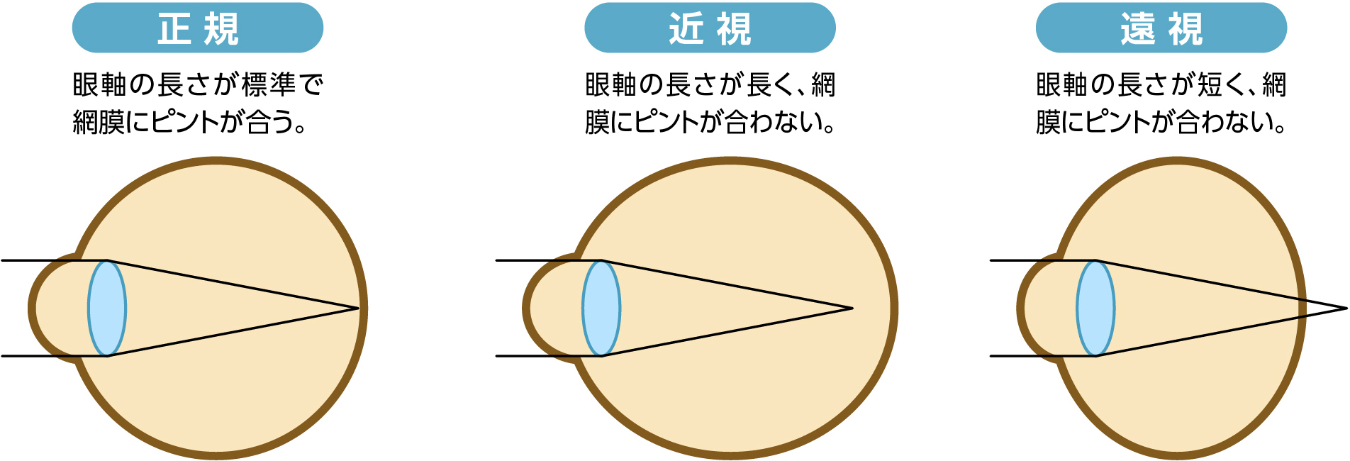 正視・遠視・近視のメカニズム