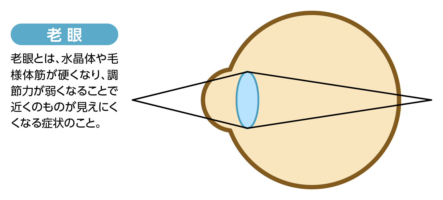 老眼による機能低下
