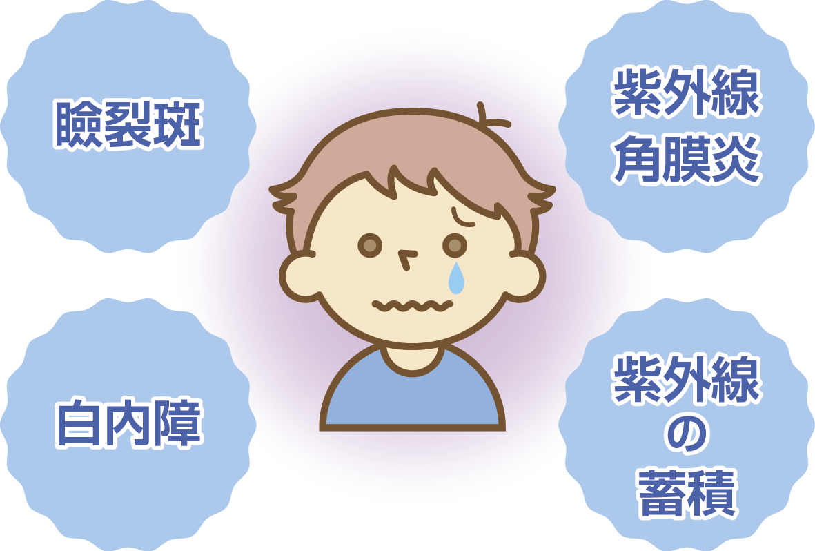 紫外線による眼へのダメージ