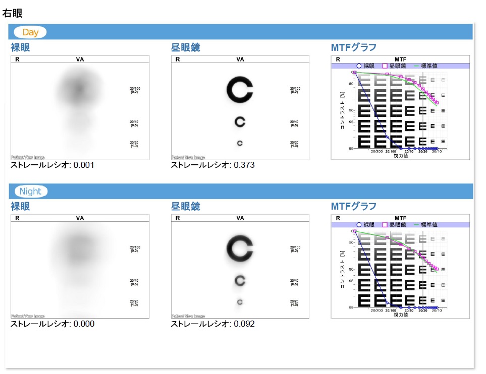 暗い環境下での「夜間視力測定」