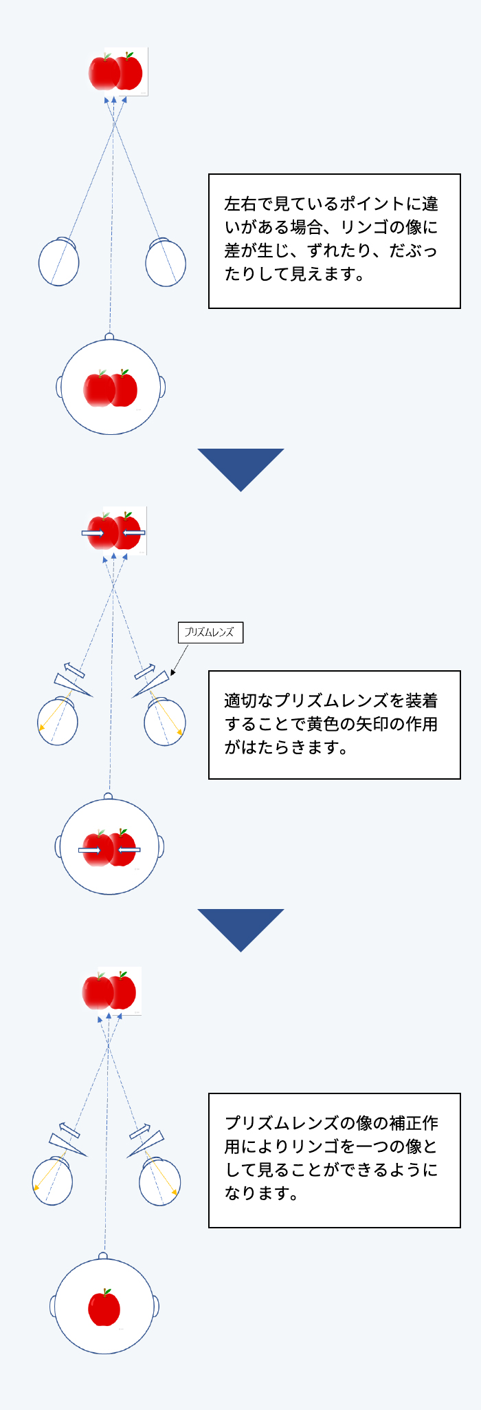 両眼での見え方のバランスを最終調整する『両眼立体サポートレンズ』