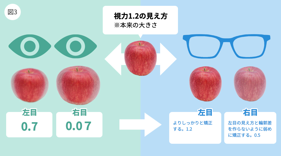 左右の度数差が大きい不同視眼の眼鏡の対応の仕方