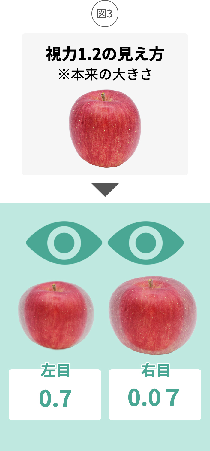 左右の度数差が大きい不同視眼の眼鏡の対応の仕方