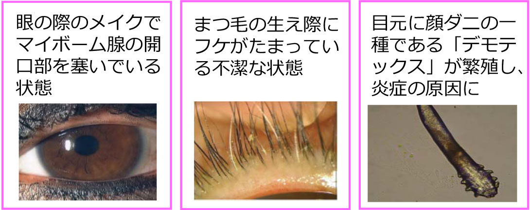 アイケアフォーラム 「目から元気にプロジェクト」レポート