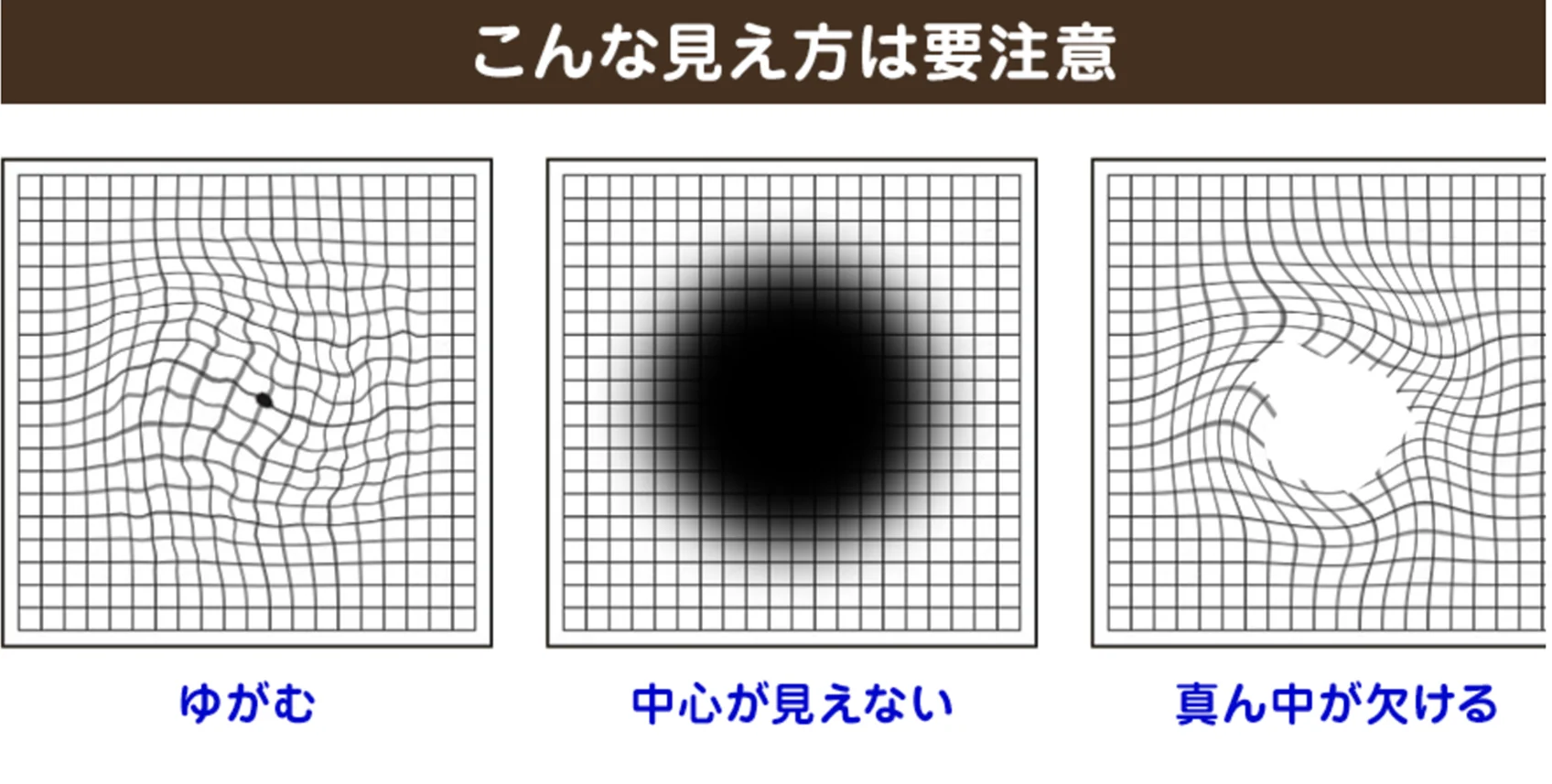 こんな見え方は要注意