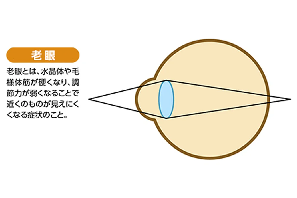 老眼のイメージ図
