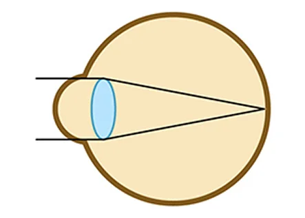 正視の図